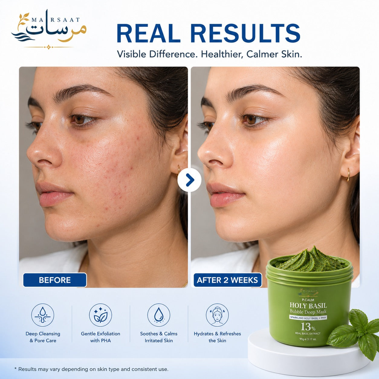 Holy Basil Bubble Deep Mask